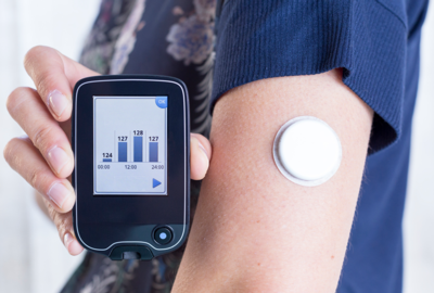 Continuous Glucose Monitors now easier to access for less